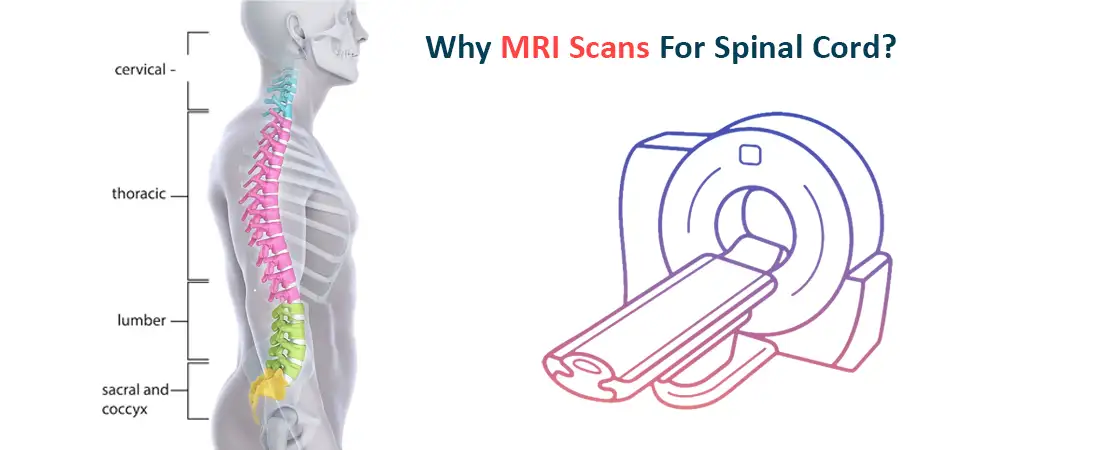 Why MRI scans for Spinal Cord